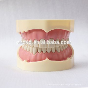 28pcs dents noir modèle anatomique FDental pour l&#39;enseignement scolaire 13006, dents de rechange Siut pour Frasaco mâchoire